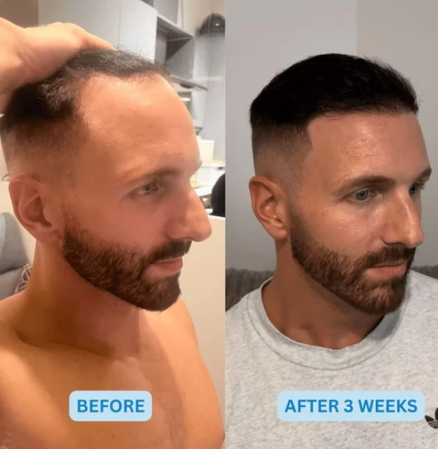 Regenix™ Hair Recovery for Men